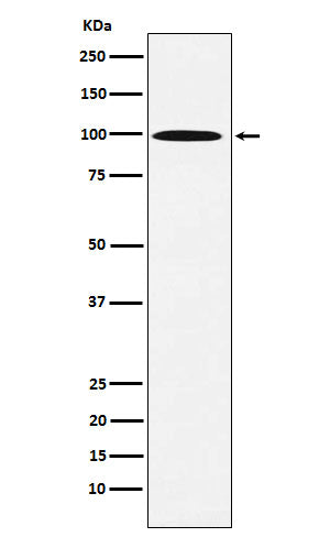 Anti-AP1G1 Rabbit Monoclonal Antibody Boster Bio