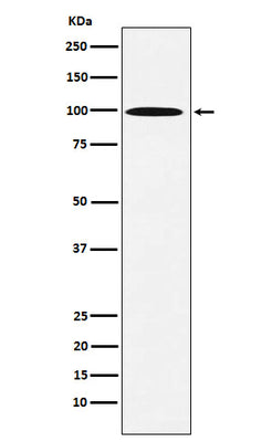Anti-AP1G1 Rabbit Monoclonal Antibody Boster Bio