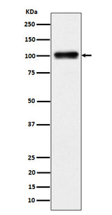 Anti-Nesprin3 Rabbit Monoclonal Antibody Boster Bio