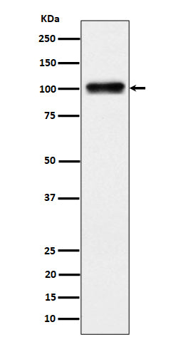 Anti-Nesprin3 Rabbit Monoclonal Antibody Boster Bio
