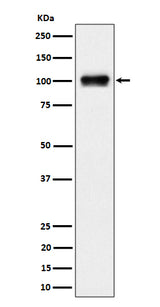 Anti-Nesprin3 Rabbit Monoclonal Antibody Boster Bio