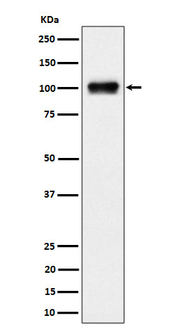 Anti-Nesprin3 Rabbit Monoclonal Antibody Boster Bio