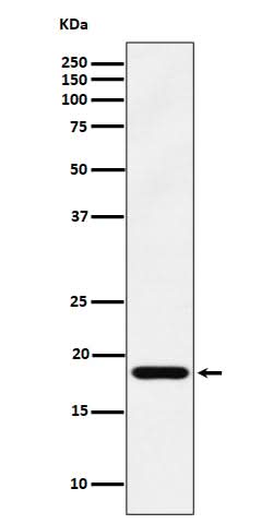 Anti-EMC4 Rabbit Monoclonal Antibody Boster Bio