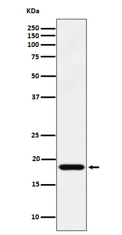 Anti-EMC4 Rabbit Monoclonal Antibody Boster Bio