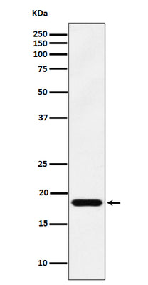Anti-EMC4 Rabbit Monoclonal Antibody Boster Bio