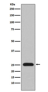 Anti-Lambda Light chain IGLV1-51 Monoclonal Antibody Boster Bio