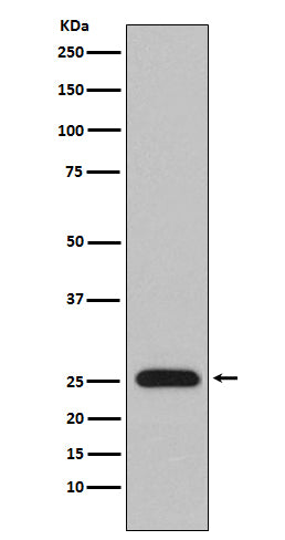 Anti-Lambda Light chain IGLV1-51 Monoclonal Antibody Boster Bio