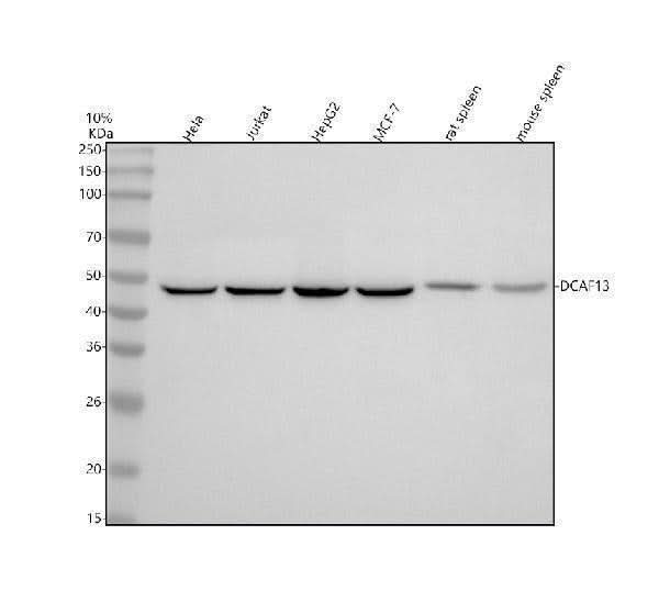 Anti-DCAF13 Rabbit Monoclonal Antibody Boster Bio