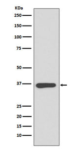 Anti-Annexin A10 Rabbit Monoclonal Antibody Boster Bio
