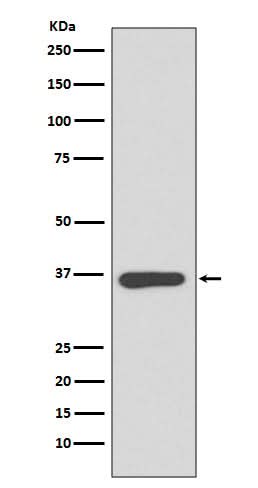 Anti-Annexin A10 Rabbit Monoclonal Antibody Boster Bio