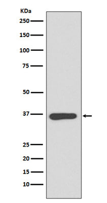 Anti-Annexin A10 Rabbit Monoclonal Antibody Boster Bio