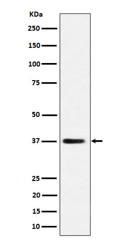 Anti-MRPS31 Rabbit Monoclonal Antibody Boster Bio