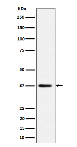 Anti-MRPS31 Rabbit Monoclonal Antibody Boster Bio