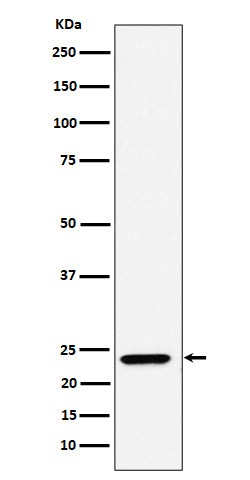Anti-DNAJC12 Rabbit Monoclonal Antibody Boster Bio