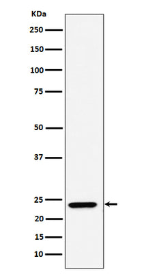 Anti-DNAJC12 Rabbit Monoclonal Antibody Boster Bio