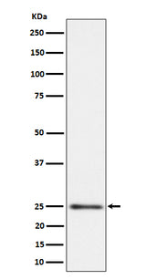 Anti-MRPS15 Rabbit Monoclonal Antibody Boster Bio