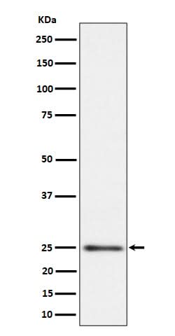Anti-MRPS15 Rabbit Monoclonal Antibody Boster Bio