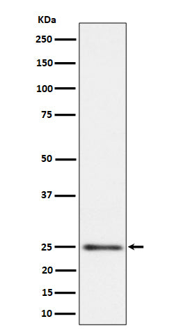 Anti-MRPS15 Rabbit Monoclonal Antibody Boster Bio