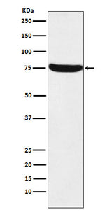 Anti-HTF9C Rabbit Monoclonal Antibody Boster Bio