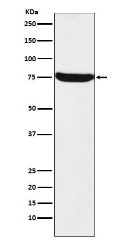 Anti-HTF9C Rabbit Monoclonal Antibody Boster Bio