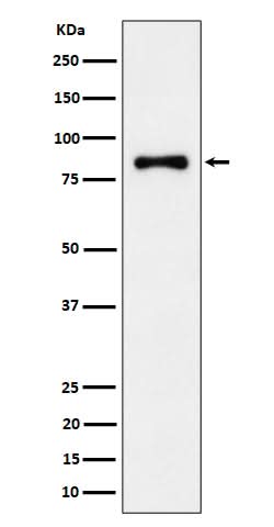 Anti-ALDH16A1 Rabbit Monoclonal Antibody Boster Bio