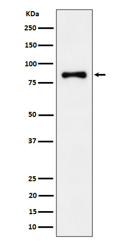 Anti-ALDH16A1 Rabbit Monoclonal Antibody Boster Bio
