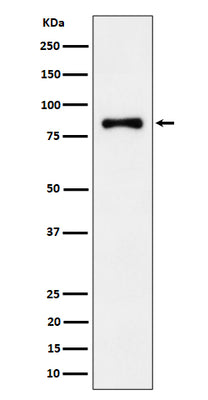 Anti-ALDH16A1 Rabbit Monoclonal Antibody Boster Bio