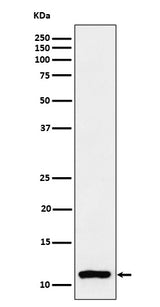 Anti-Histone H4 (mono methyl K20) Rabbit Monoclonal Antibody Boster Bio