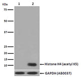 Anti-Histone H4 (acetyl K5) HIST1H4A Monoclonal Antibody Boster Bio