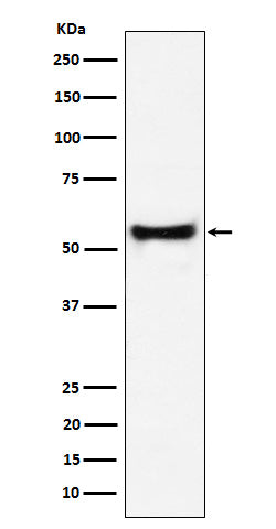 Anti-PDCD7 Rabbit Monoclonal Antibody Boster Bio