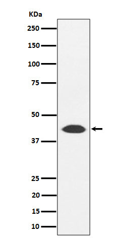 Anti-NUDT19 Rabbit Monoclonal Antibody Boster Bio