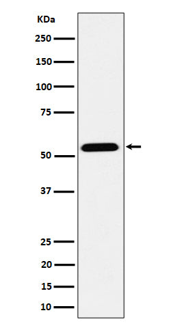 Anti-ENPP5 Rabbit Monoclonal Antibody Boster Bio
