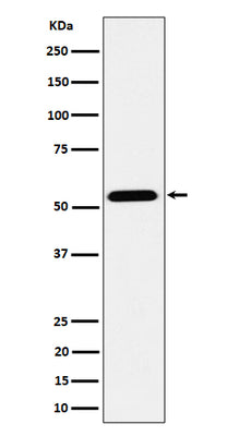 Anti-ENPP5 Rabbit Monoclonal Antibody Boster Bio