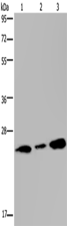 Anti-Human/Mouse/Rat RAB3c Antibody - ABMIUM