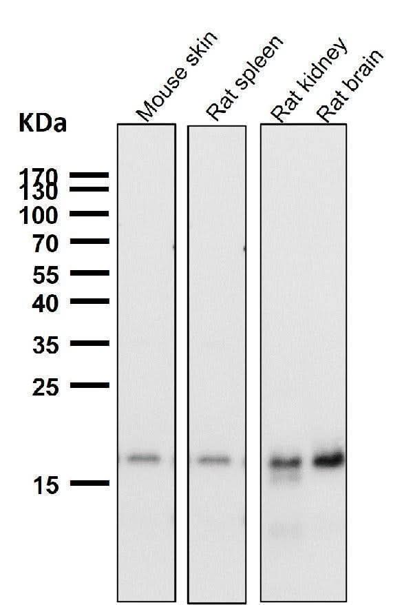 Anti-TIMM22 Rabbit Monoclonal Antibody Boster Bio