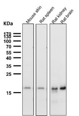 Anti-TIMM22 Rabbit Monoclonal Antibody Boster Bio