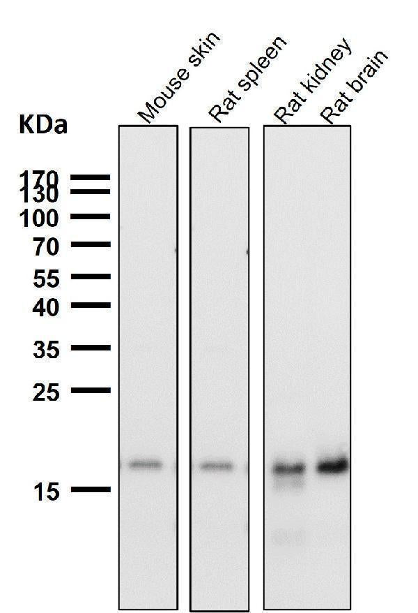 Anti-TIMM22 Rabbit Monoclonal Antibody Boster Bio