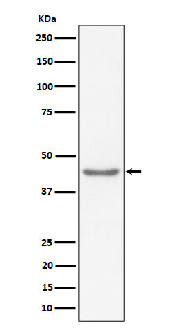 Anti-RBMXL2 Rabbit Monoclonal Antibody Boster Bio