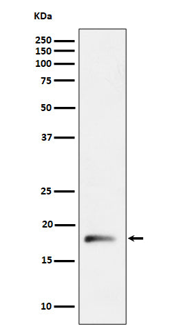 Anti-RPL26L1 Rabbit Monoclonal Antibody Boster Bio