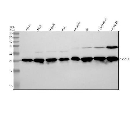 Anti-AKAP14 Rabbit Monoclonal Antibody Boster Bio
