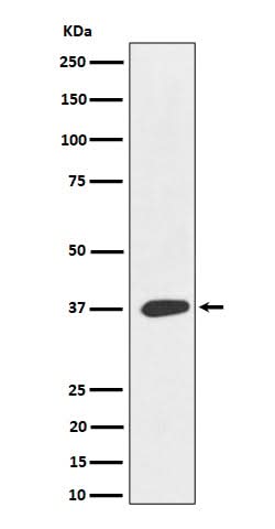 Anti-MAS1L Rabbit Monoclonal Antibody Boster Bio