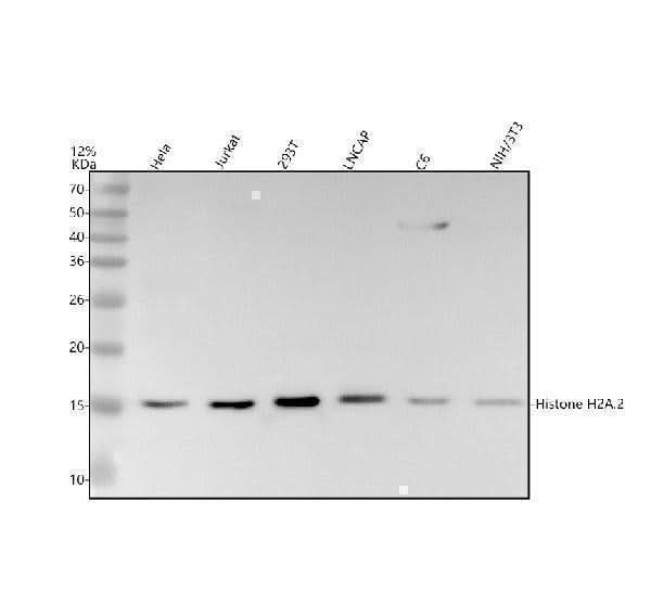 Anti-Histone H2A HIST1H2AB Rabbit Monoclonal Antibody Boster Bio