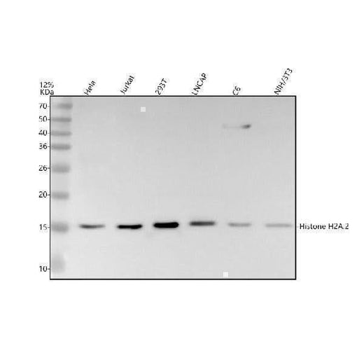 Anti-Histone H2A HIST1H2AB Rabbit Monoclonal Antibody Boster Bio