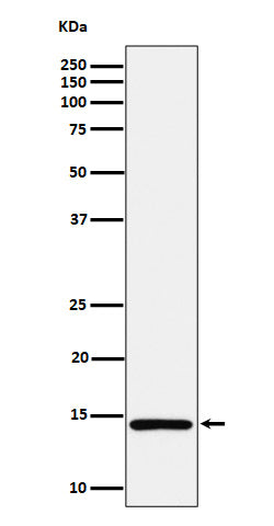 Anti-Histone H2A (mono methyl K118) Rabbit Monoclonal Antibody Boster Bio