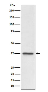 Anti-C3orf38 Rabbit Monoclonal Antibody Boster Bio