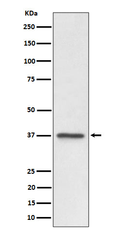 Anti-C3orf38 Rabbit Monoclonal Antibody Boster Bio