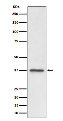 Anti-C3orf38 Rabbit Monoclonal Antibody Boster Bio