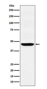 Anti-SEC61A Rabbit Monoclonal Antibody Boster Bio