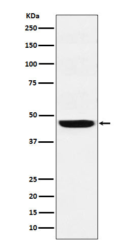 Anti-SEC61A Rabbit Monoclonal Antibody Boster Bio