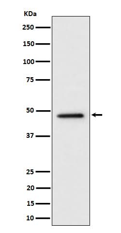 Anti-TOR4A Rabbit Monoclonal Antibody Boster Bio